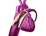 dr-ozner-heart